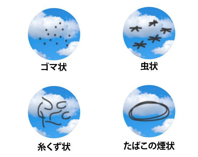 ドライアイについて
